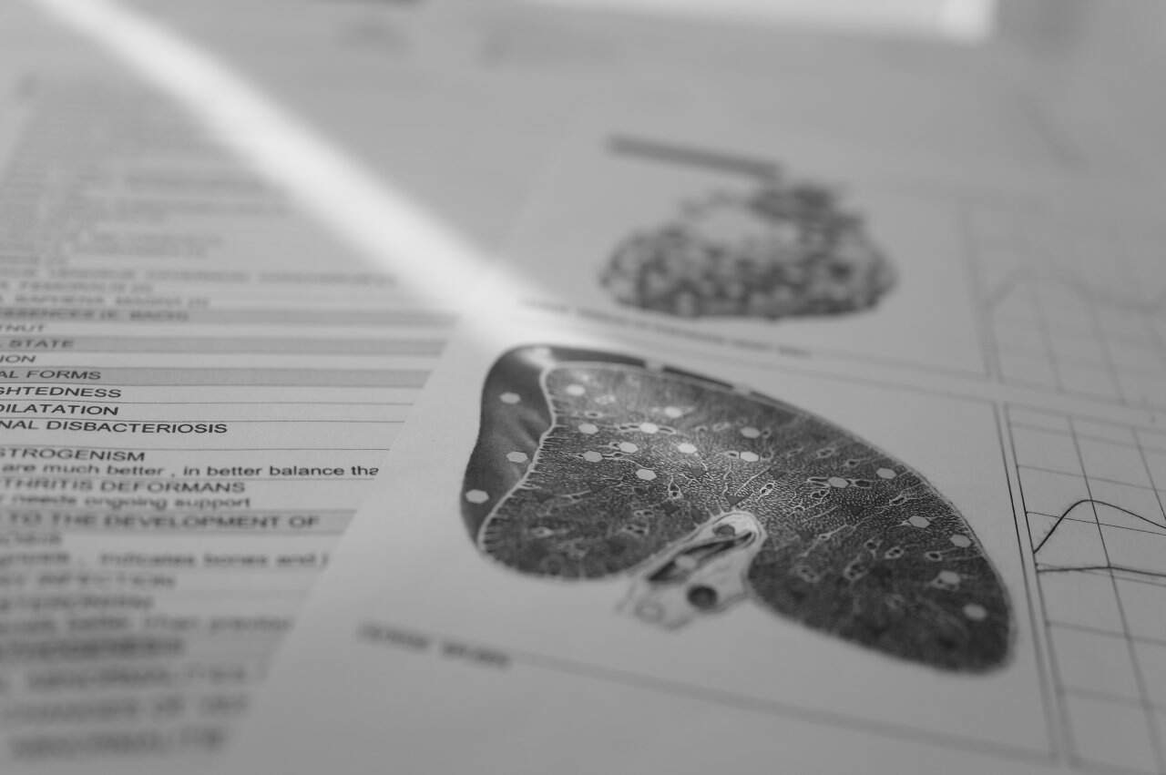 Nls Diagnostic Patient Treatment Lung Analysis Medical Report Printed Document - integrative healthcare treatment at Healers Clinic Dubai