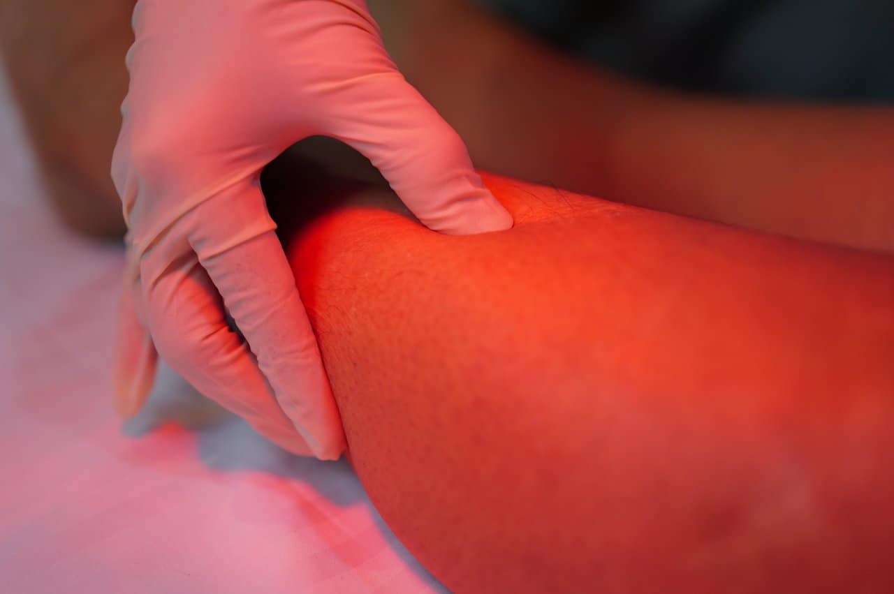 Physiotherapy Manual Palpation Trigger Point Assessment Thigh Muscle - integrative healthcare treatment at Healers Clinic Dubai