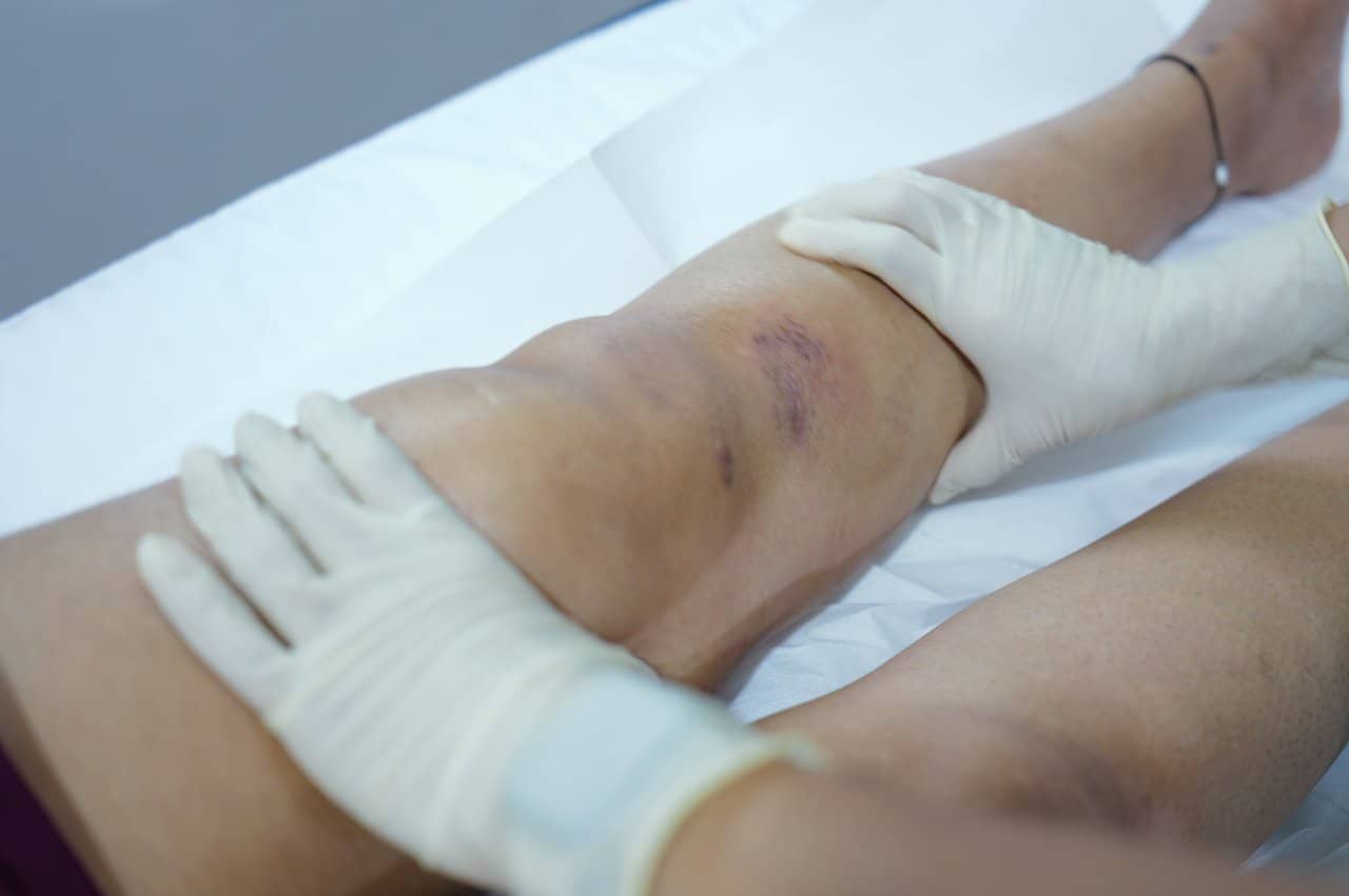 Physiotherapy Follow Up Care - integrative healthcare treatment at Healers Clinic Dubai
