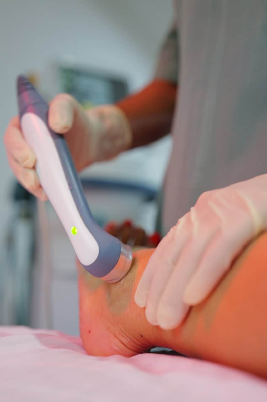 Physiotherapy Ultrasound Therapy Foot Ankle Achilles Tendon Treatment - integrative healthcare treatment at Healers Clinic Dubai