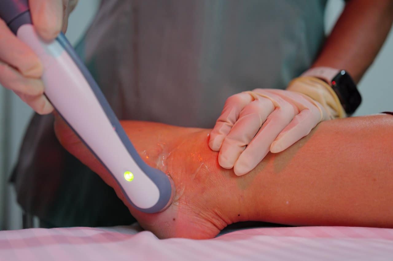 Physiotherapy Ultrasound Therapy Foot Plantar Fascia Treatment Smartwatch - integrative healthcare treatment at Healers Clinic Dubai