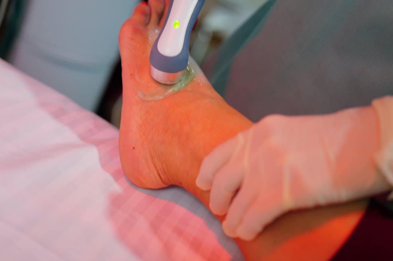 Physiotherapy Ultrasound Treatment Foot Heel Gel Application Therapy - integrative healthcare treatment at Healers Clinic Dubai