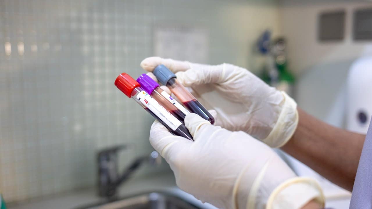 Medical-grade blood sample collection with test tubes